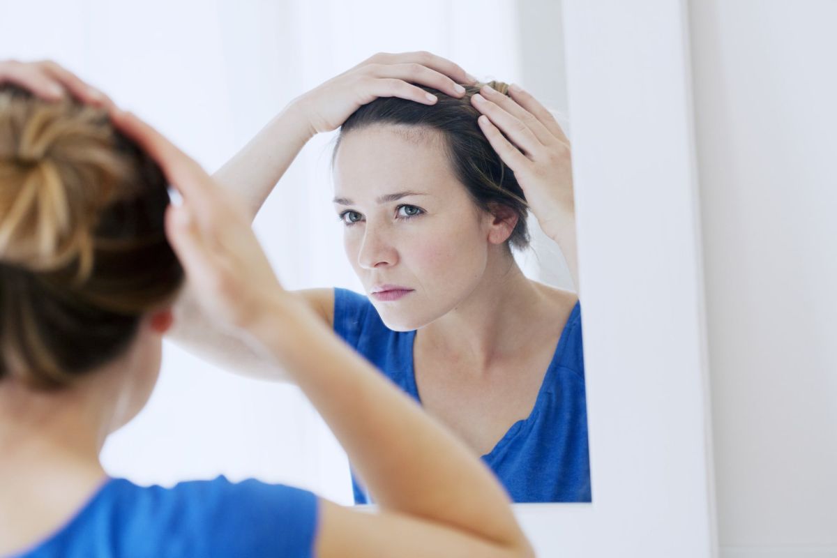 Receding Hairline on woman