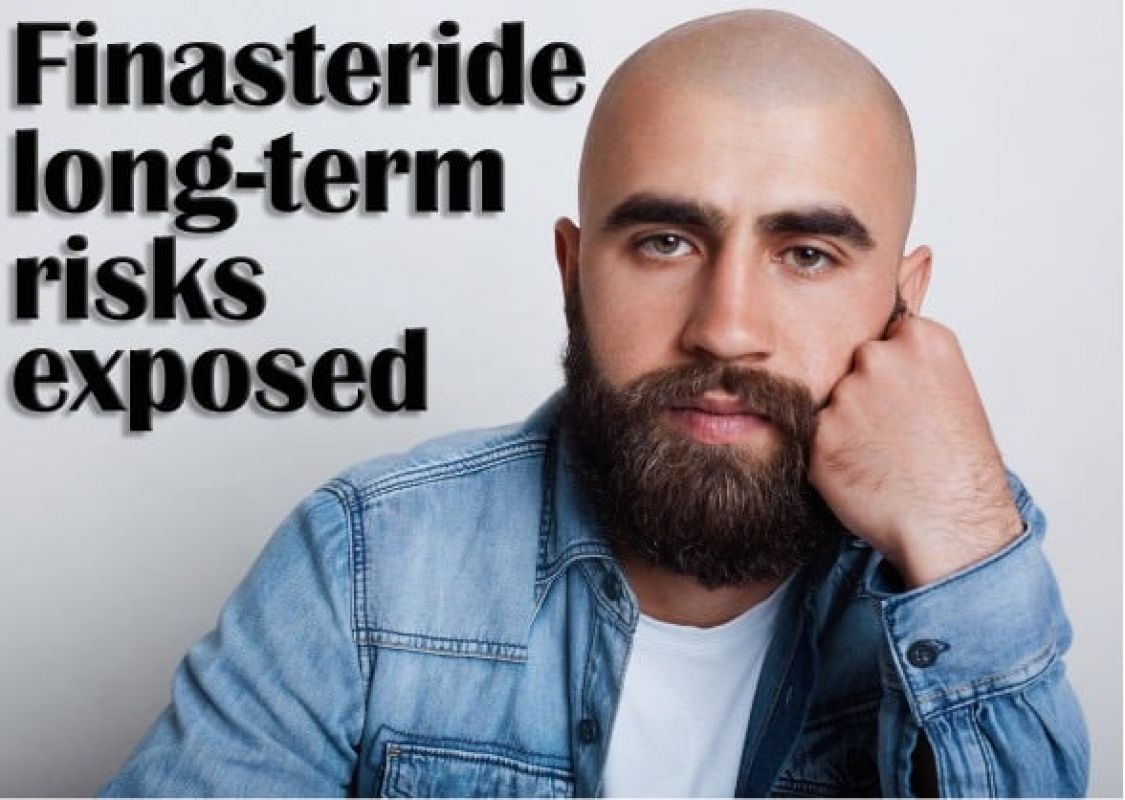 finasteride associated with risks