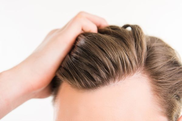 stages of hair loss