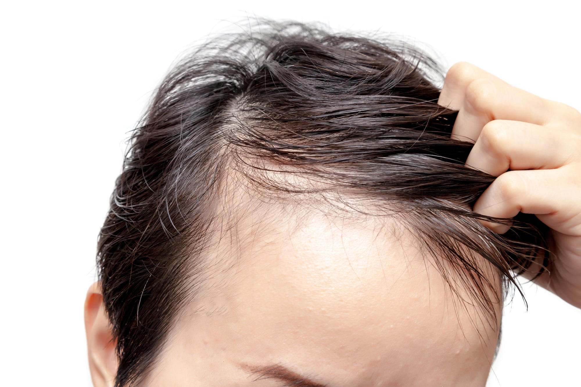 Thinning Hair Signs The Essential Guide to the Signs of